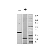 Human Growth and Differentiation Factor-15 Recombinant Protein