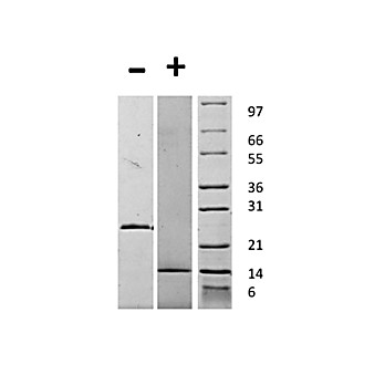 Human Growth and Differentiation Factor-15 Recombinant Protein