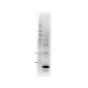 Procalcitonin (15F6.F6.F9)