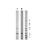 Human globular ACRP-30 Recombinant Protein