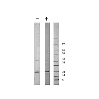 Human globular ACRP-30 Recombinant Protein