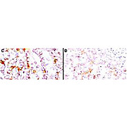 Anti-Mesothelin (MOUSE) Monoclonal Antibody