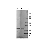 Human Sonic Hedgehog Recombinant Protein
