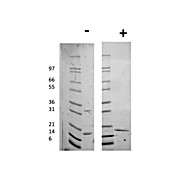 Human Interleukin-16 Recombinant Protein