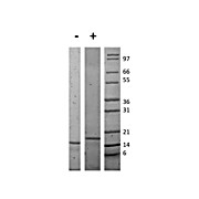 Mouse Interleukin-16 Recombinant Protein