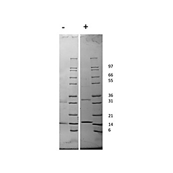 Rat Granulocyte Macrophage-Colony Stimulating Factor Recombinant Protein
