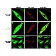 Anti-FRUCTOSE-6-PHOSPHATE KINASE (GOAT) Antibody