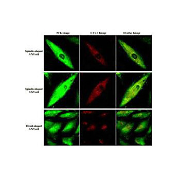 Anti-FRUCTOSE-6-PHOSPHATE KINASE (GOAT) Antibody