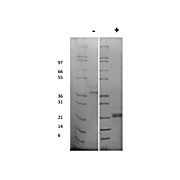 Rat Vascular Endothelial Growth Factor-165 Recombinant Protein