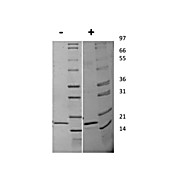Human Interleukin-20 Recombinant Protein
