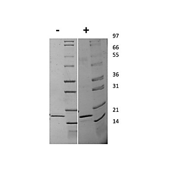 Human Interleukin-20 Recombinant Protein