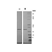 Human Epstein-Barr Virus Induced Gene 3 Recombinant Protein (Animal Free)