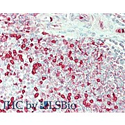 Anti-CARBONIC ANHYDRASE I (GOAT) Antibody
