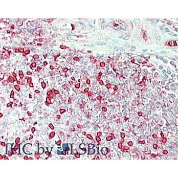 Anti-CARBONIC ANHYDRASE I (GOAT) Antibody