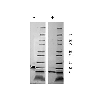 Mouse Stromal Cell-Derived Factor-1 alpha (CXCL12) Recombinant Protein