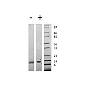 Human Galectin-1 Recombinant Protein
