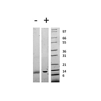 Human Galectin-1 Recombinant Protein