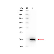 Anti-Carbonic Anhydrase II HRP Hu