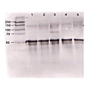 Anti-Angiopoietin 1 (RABBIT) Antibody