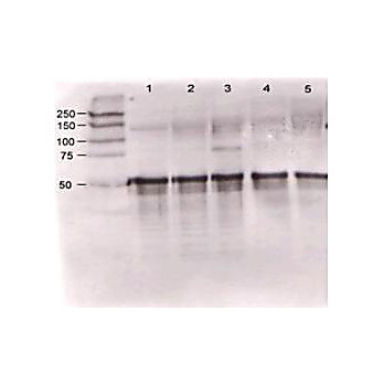 Anti-Angiopoietin 1 (RABBIT) Antibody