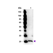Anti-FERRITIN (Human Spleen) (RABBIT) Antibody