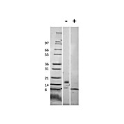 Mouse RELM beta Recombinant Protein