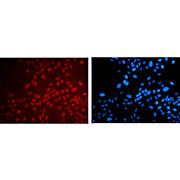 Anti-PAX6 (MOUSE) Monoclonal Antibody