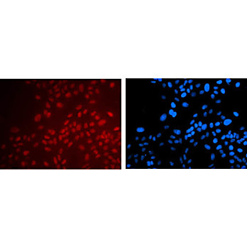 Anti-PAX6 (MOUSE) Monoclonal Antibody
