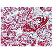 Anti-TRPC6 (MOUSE) Monoclonal Antibody