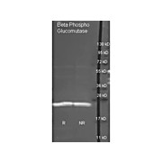 Anti-BETA-PHOSPHOGLUCOMUTASE (GOAT) Antibody Biotin Conjugated