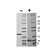 Human Growth and Differentiation Factor-15 (D variant) Recombinant Protein