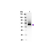 Anti-GLUTAMINE SYNTHETASE (GOAT) Antibody