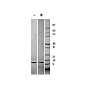 Human Gro Alpha (CXCL1) Recombinant Protein