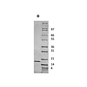 Mouse Interleukin-2 Recombinant Protein