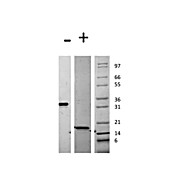 Mouse Platelet Derived Growth Factor AA Recombinant Protein