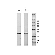 Human Ciliary Neurotrophic Factor Recombinant Protein