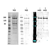 Morc3 Antibody hu
