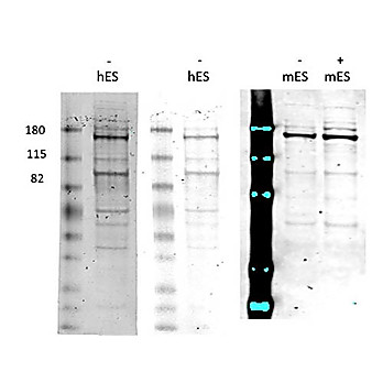 Morc3 Antibody hu