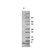 Rat Insulin-like Growth Factor I Recombinant Protein