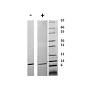 Human Migration Inhibitory Factor Recombinant Protein