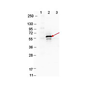 Anti-DbpB (RABBIT) Antibody