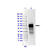 Anti-SARS-CoV-2 Nucleocapsid (N) Protein (RABBIT) Antibody