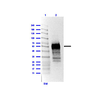 Anti-SARS-CoV-2 Nucleocapsid (N) Protein (RABBIT) Antibody
