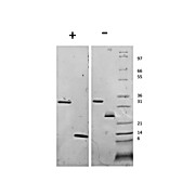 Human Myostatin Propeptide Recombinant Protein
