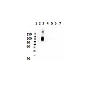 Anti-HbA-2 (MOUSE) Monoclonal Antibody