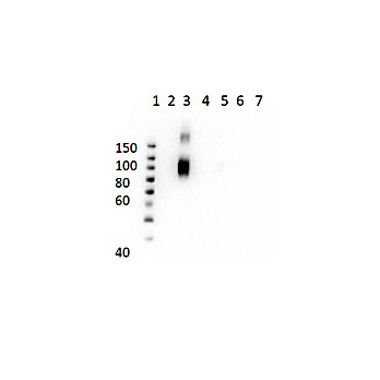 Anti-HbA-2 (MOUSE) Monoclonal Antibody
