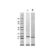 Rat Macrophage Inflammatory Protein-1 alpha (CCL3) Recombinant Protein