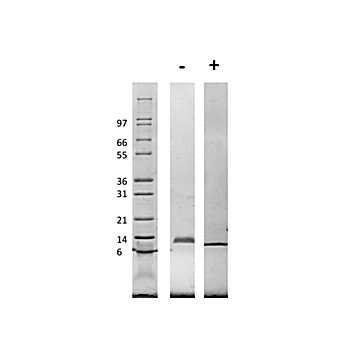 Rat Macrophage Inflammatory Protein-1 alpha (CCL3) Recombinant Protein