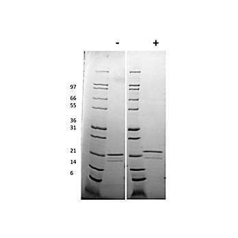 Human Interleukin-6 Recombinant Protein (Animal Free)