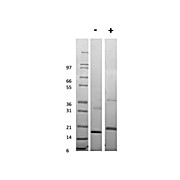 Human Tumor Necrosis Factor Receptor Type 1 Recombinant Protein